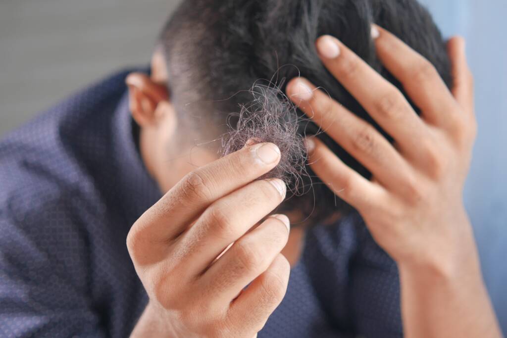 male hair loss in tribeca nyc
