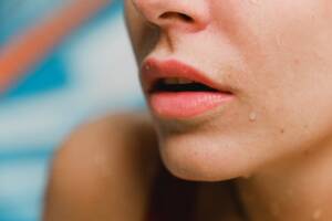 The Best Botox Lip Flip in Manhattan 