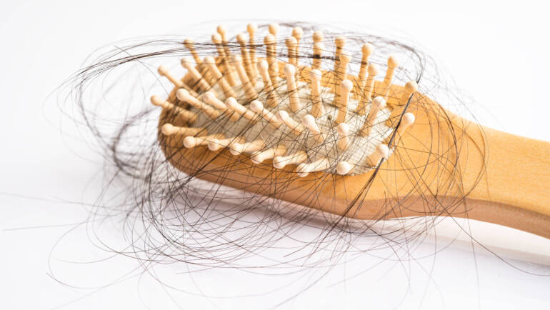 hair loss dermatologist new york city