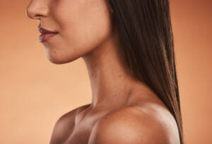 laser resurfacing New York