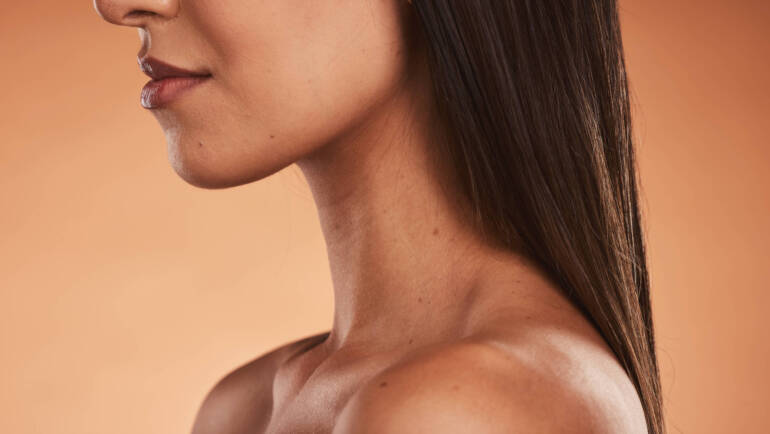 laser resurfacing New York