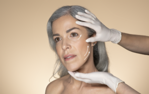 XERF treatment in NYC