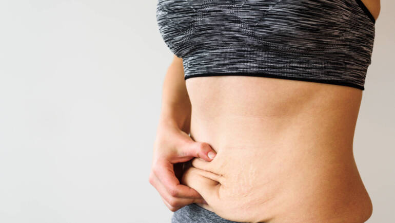 non surgical skin tightening in nyc